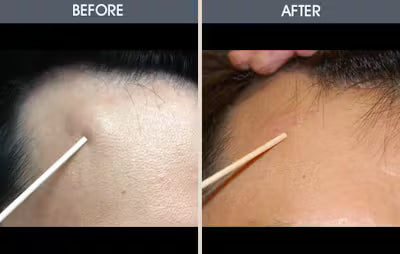 Noticeable Size Reduction
