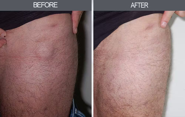 Visible Improvement