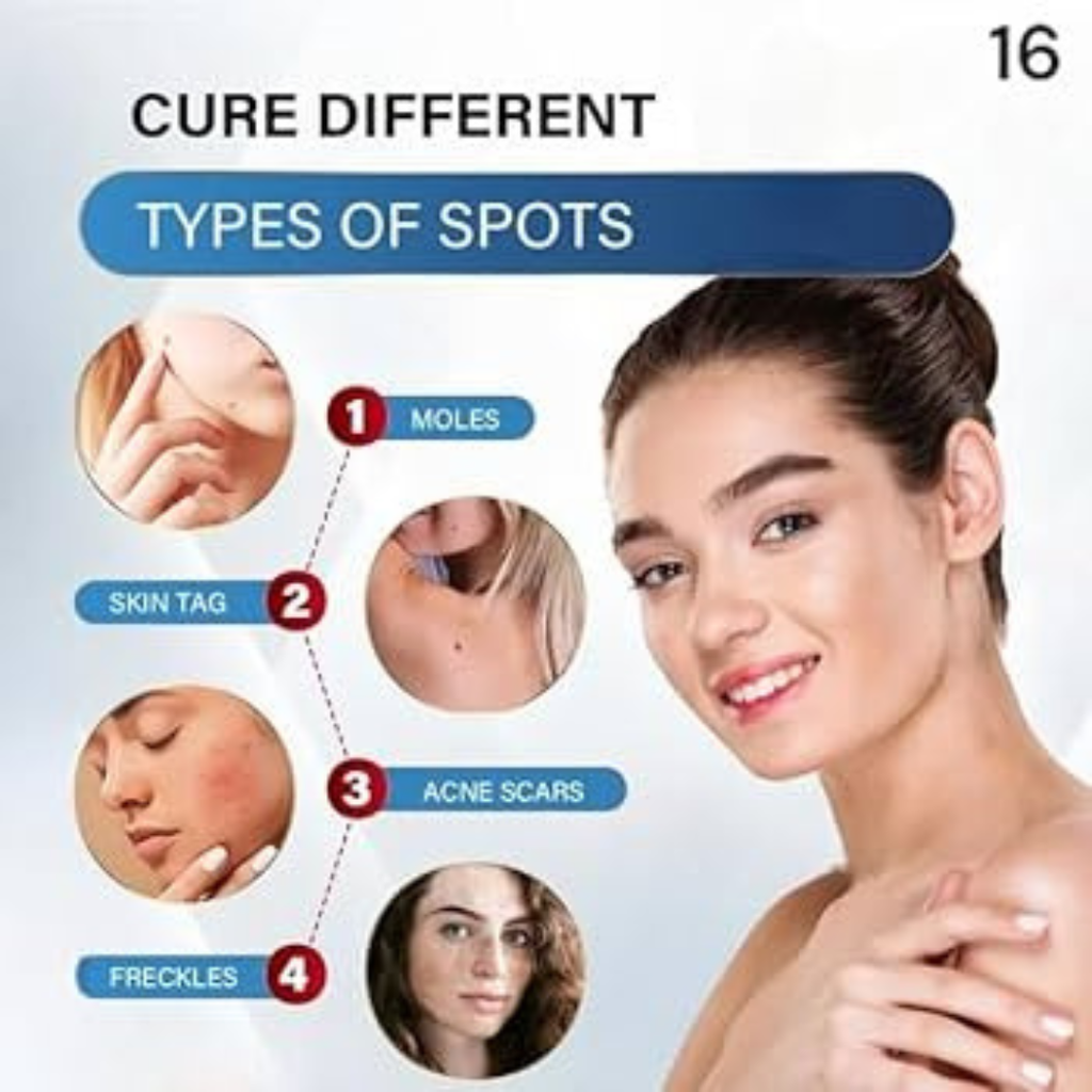 Timilk Wart & Mole Removal Spray
