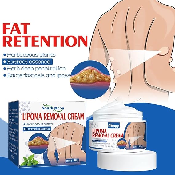 South Moon Lipoma Removal Cream (Pack of 3)