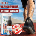 Varicose Veins Treatment