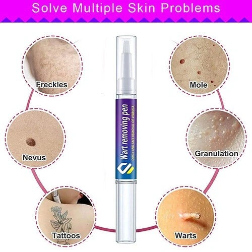 Warts, Moles & Skin Tags Remover Pen
