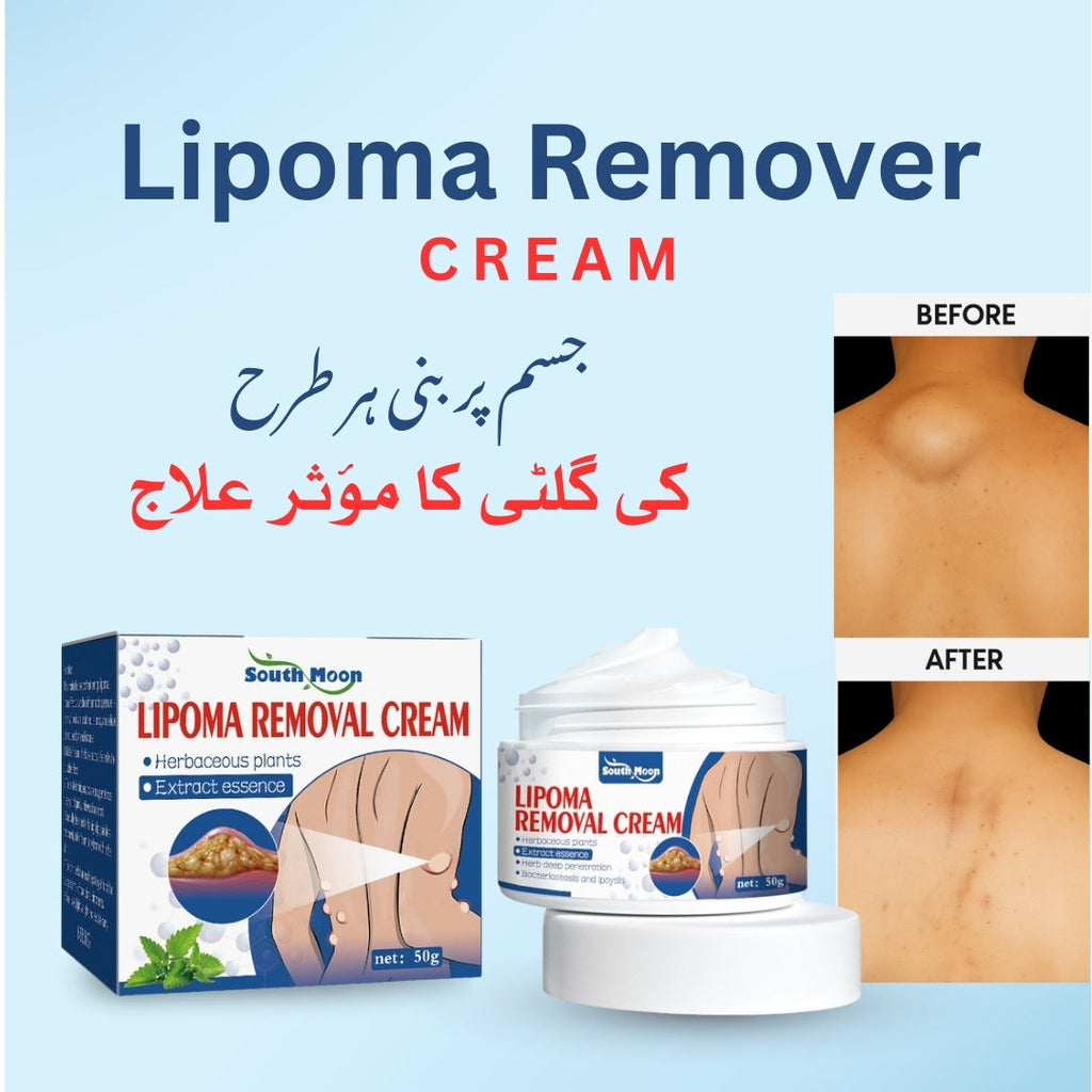 South Moon Lipoma Removal Cream (Pack of 3)
