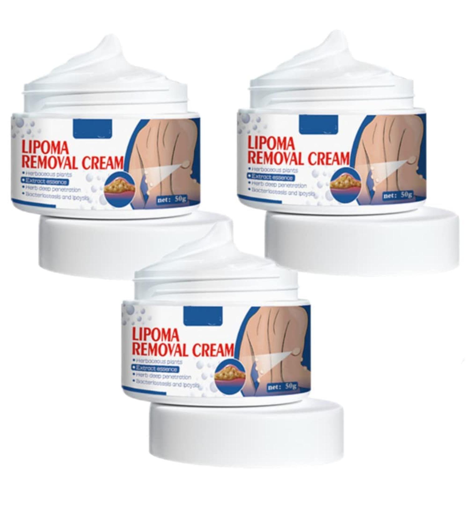 South Moon Lipoma Removal Cream (Pack of 2)