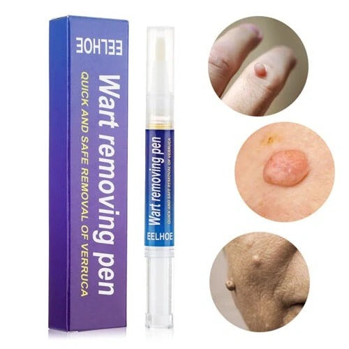 Warts, Moles & Skin Tags Remover Pen